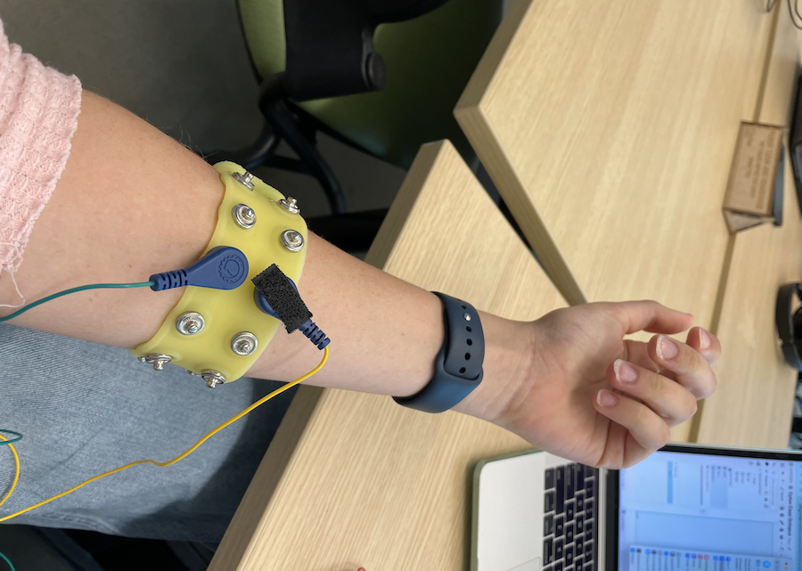snap-yellow-armband-with-wires.BIS5vz5w.png